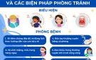 Bệnh Bạch hầu và Các biện pháp phòng bệnh